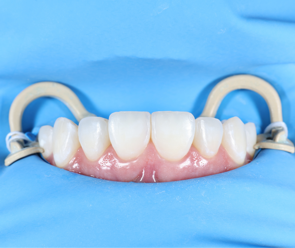 odontología estética en Teusaquillo Bogotá