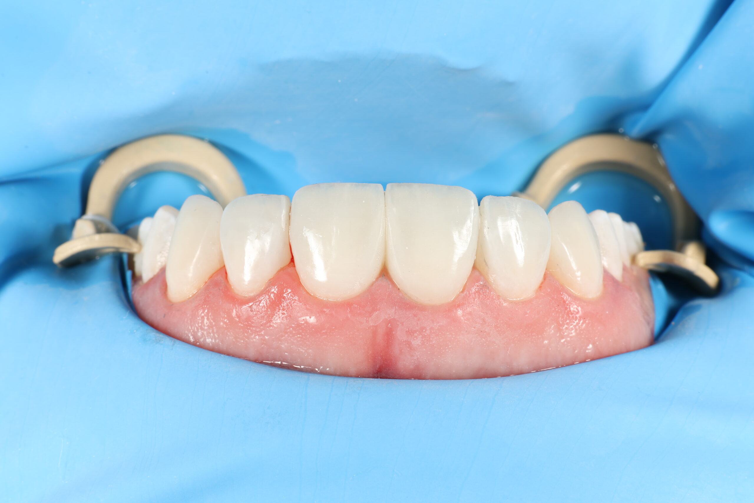 odontología estética en Teusaquillo Bogotá