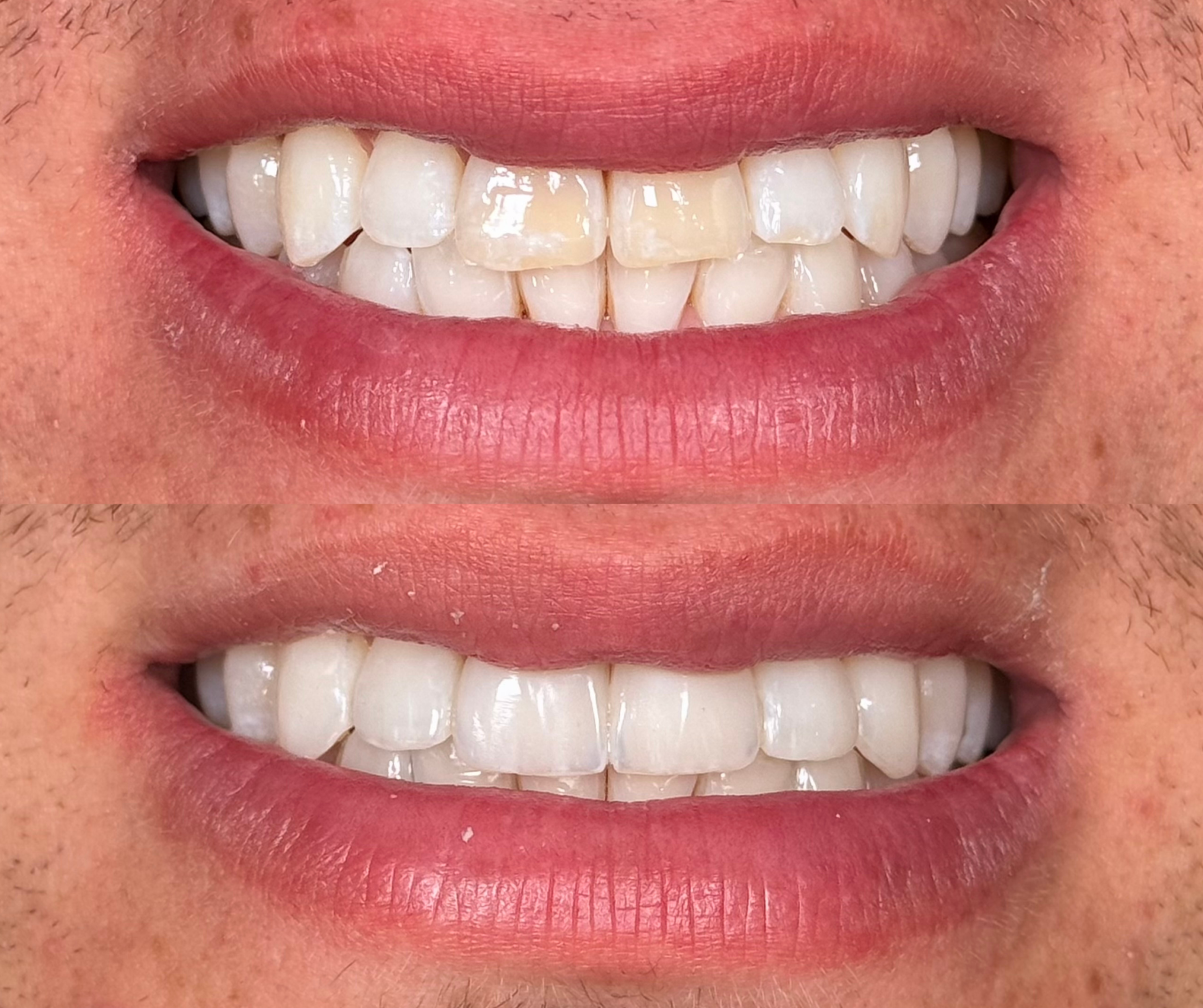 estética dental